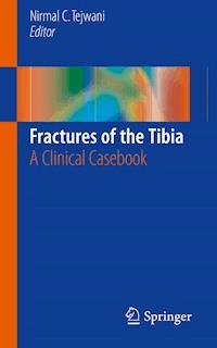 Fractures of the Tibia - - ebook