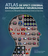 Atlas de spect cerebral en psiquiatria y neurología - VV. AA. - ebook
