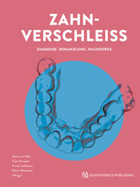 Zahnverschleiß - Hans van Pelt - ebook