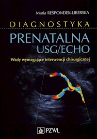 Diagnostyka prenatalna USG/ECHO - Respondek-Liberska Maria - książka