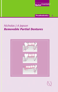 Removable Partial Dentures - Nicholas J. A. Jepson - ebook
