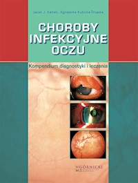 Choroby infekcyjne oczu - Kański Jacek J., Kubicka-Trząska Agnieszka - książka