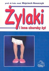 Żylaki i inne choroby żył - Wojciech Noszczyk - książka