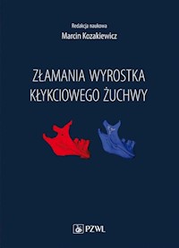 Złamania wyrostka kłykciowego żuchwy -  - książka
