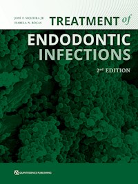 Treatment of Endodontic Infections -  - ebook