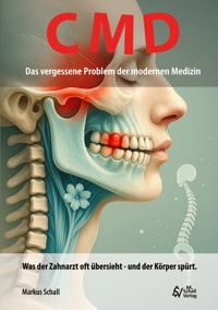 CMD - Das vergessene Problem der modernen Medizin - Markus Schall - ebook