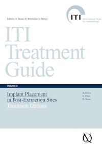 Implant Placement in Post-Extraction Sites -  - ebook