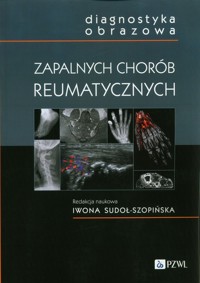 Diagnostyka obrazowa zapalnych chorób reumatycznych - praca zbiorowa - książka