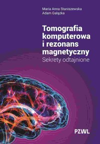 Tomografia komputerowa i rezonans magnetyczny. Sekrety odtajnione - Adam Gałązka, Maria Anna Staniszewska - książka