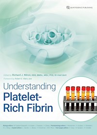 Understanding Platelet-Rich Fibrin - Richard J. Miron - ebook