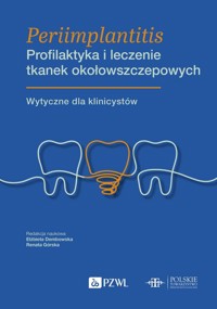 Periimplantitis Profilaktyka i leczenie tkanek okołowszczepowych - Dembowska Elżbieta, Górska Renata - książka