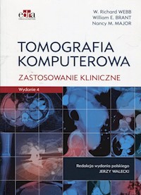 Tomografia komputerowa Zastosowanie kliniczne - Webb Richard W., Brant William E., Major Nancy M. - książka