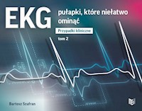 EKG pułapki, które niełatwo ominąć Przypadki kliniczne tom 2 - Szafran Bartosz - książka