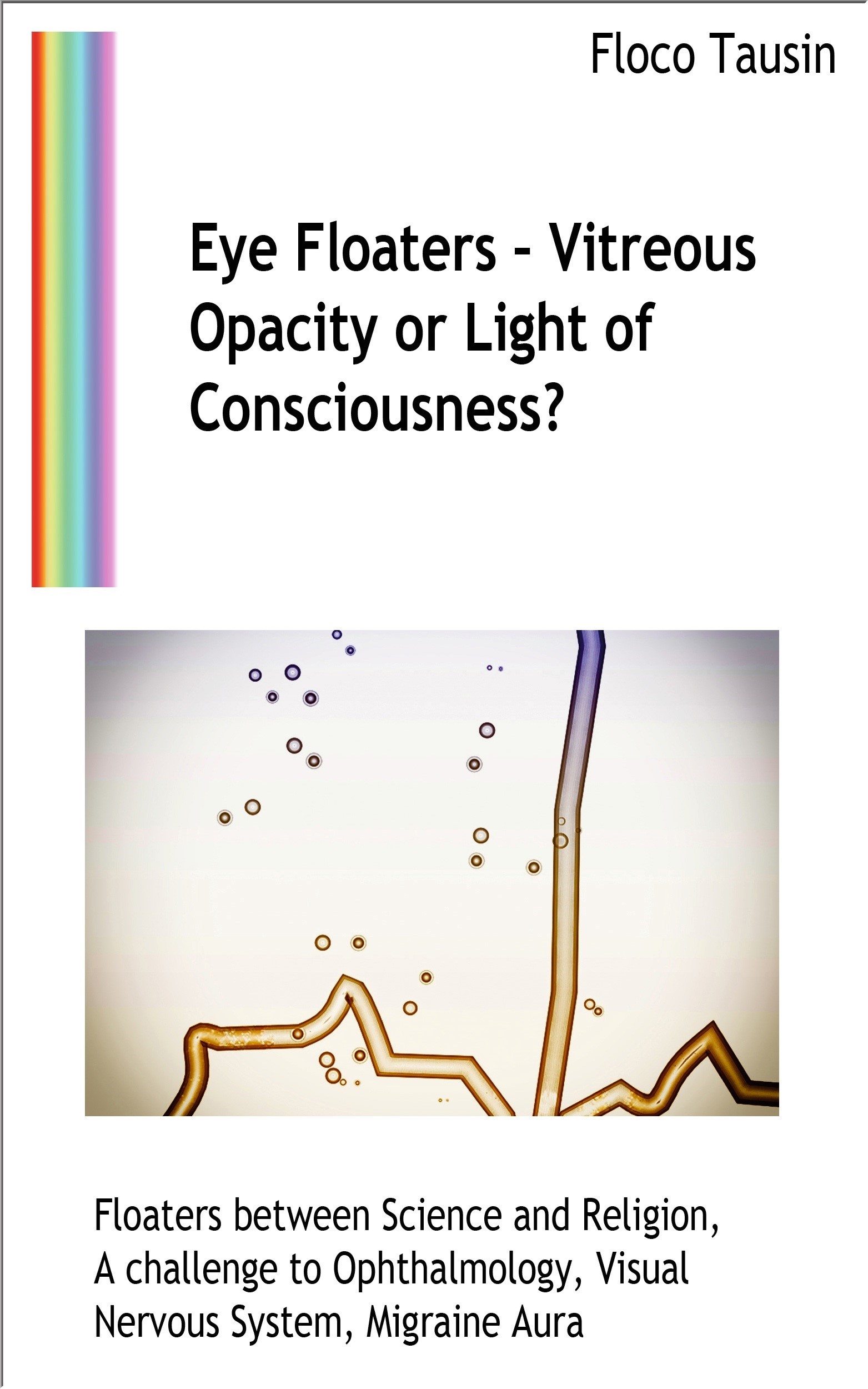 Eye Floaters - Vitreous Opacity or Light of Consciousness?