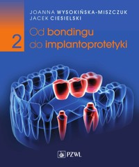Od bondingu do implantoprotetyki. Część 2 - Jacek Ciesielski, Joanna Wysokińska-Miszczuk - książka