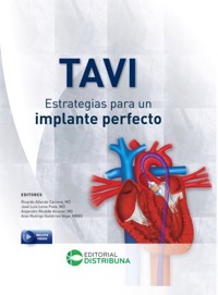 TAVI - Estrategias para un implante perfecto - Ricardo Allende Carrera - ebook