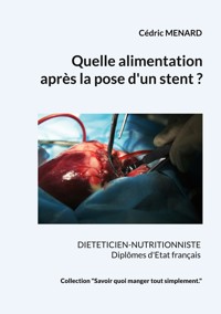 Quelle alimentation après la pose d'un stent ? - Menard Cédric - ebook