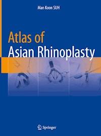 Atlas of Asian Rhinoplasty - Man Koon SUH - ebook