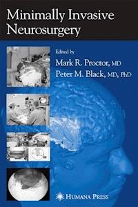 Minimally Invasive Neurosurgery - - ebook