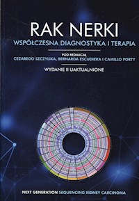 Rak nerki Współczesna diagnostyka i terapia -  - książka