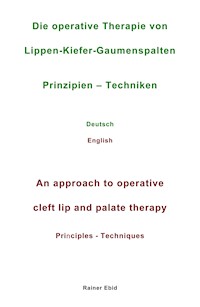 Die operative Therapie von Lippen-Kiefer-Gaumenspalten   Prinzipien  - Techniken   Deutsch   English   An approach to operative cleft lip and palate therapy   Principles - Techniques - Rainer Ebid - ebook