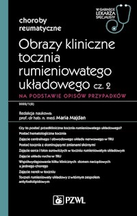 Obrazy kliniczne tocznia rumieniowatego układowego Część 2 - Majdan Maria - książka