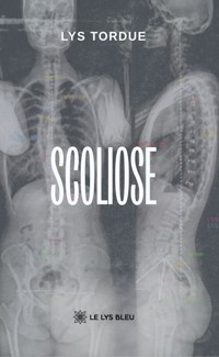 Scoliose - Lys Tordue - ebook