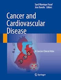 Cancer and Cardiovascular Disease -  - ebook