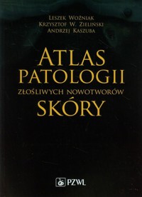 Atlas patologii złośliwych nowotworów skóry - Leszek Woźniak, Krzysztof W. Zieliński, Andrzej Kaszuba - książka