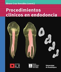 Procedimientos clínicos en endodoncia - Álvaro Cruz González - ebook