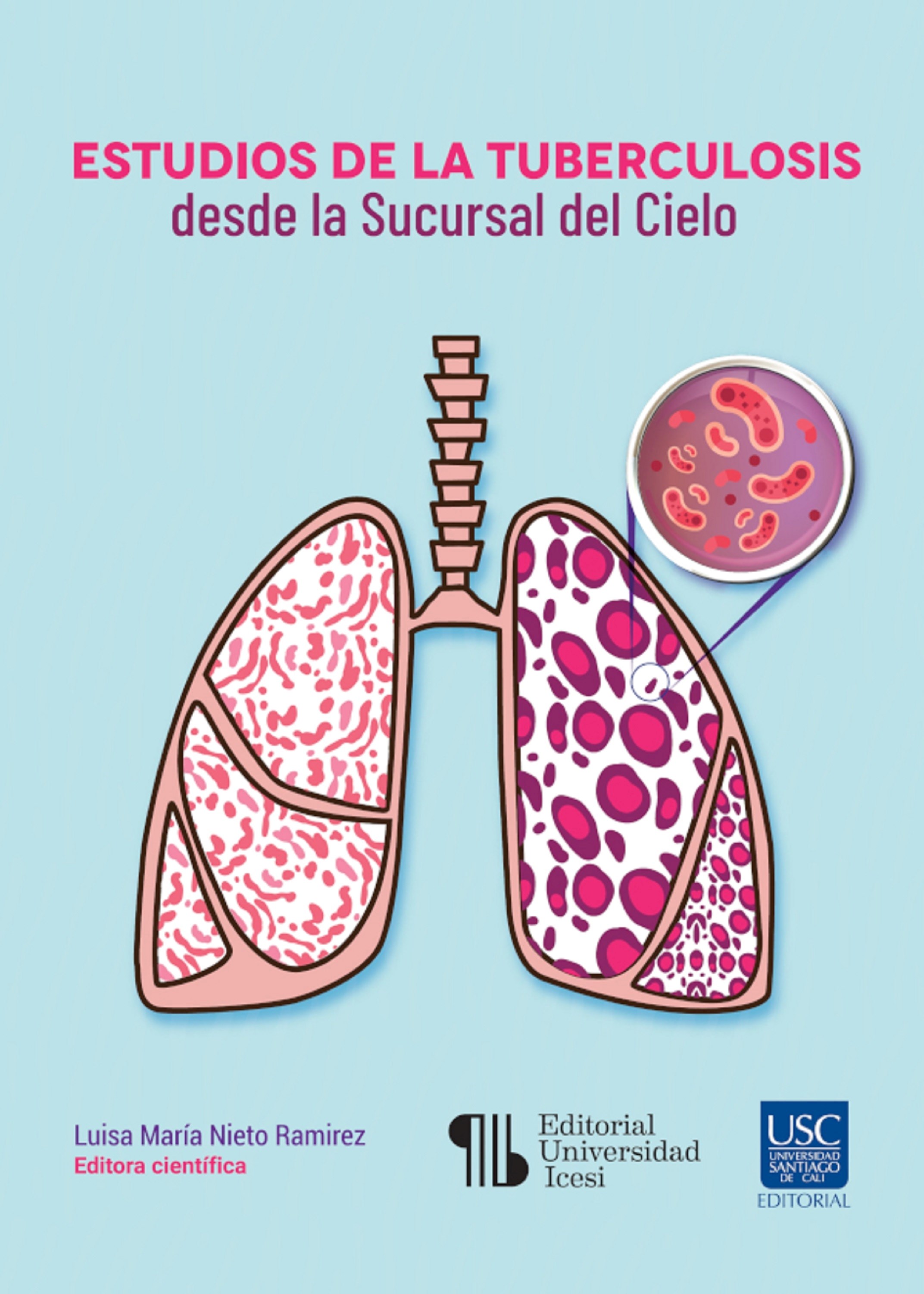 Estudios de la tuberculosis desde la Sucursal del Cielo