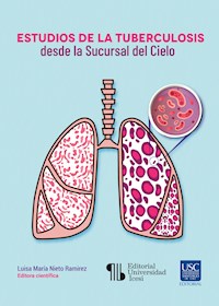 Estudios de la tuberculosis desde la Sucursal del Cielo - Luisa María Nieto Ramirez - ebook