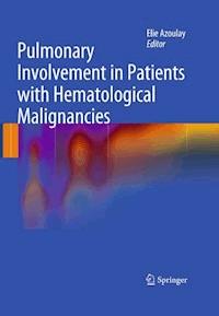 Pulmonary Involvement in Patients with Hematological Malignancies - - ebook