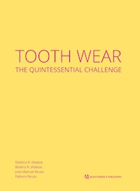 Tooth Wear - Débora R. Vilaboa - ebook