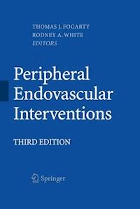 Peripheral Endovascular Interventions - - ebook