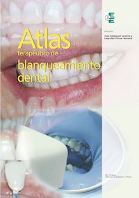 Atlas terapéutico de blanqueamiento dental - José Amengual Lorenzo - ebook