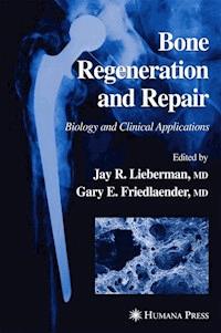 Bone Regeneration and Repair -  - ebook