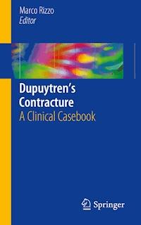 Dupuytren’s Contracture -  - ebook