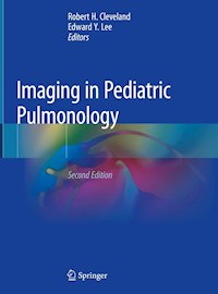 Imaging in Pediatric Pulmonology -  - ebook