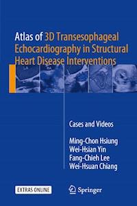 Atlas of 3D Transesophageal Echocardiography in Structural Heart Disease Interventions - Ming-Chon Hsiung - ebook