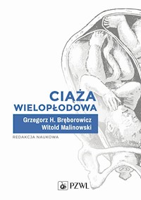 Ciąża wielopłodowa - Bręborowicz Grzegorz H., Malinowski Witold - książka