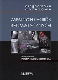 Diagnostyka obrazowa zapalnych chorób reumatycznych - Sudoł-Szopińska  Iwona - książka