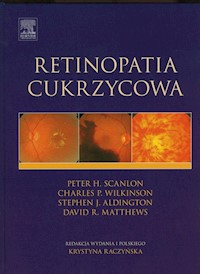 Retinopatia cukrzycowa - Scanlon Peter H., Wilkinson Charles P., Aldington Stephen J., Matthews David R. - książka