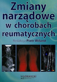 Zmiany narządowe w chorobach reumatycznych - Wiland Piotr - książka