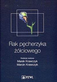 Rak pęcherzyka żółciowego -  - książka