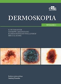 Dermoskopia - Soyer H.P. , Argenziano G. , Hofmann-Wellenhof R. , Zalaudek I. - książka