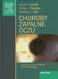 Choroby zapalne oczu - Kański Jacek J., Pavesio Carlos E., Tuft Stephen J. - książka