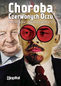 Choroba czerwonych oczu - Stanisław Michalkiewicz - ebook + książka