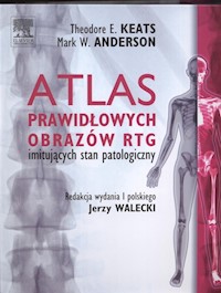 Atlas prawidłowych  obrazów RTG imitujących stan patologiczny - Anderson Mark, Keats Theodore Walecki Jerzy - książka