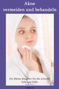 Akne - Max Rat-Geber - ebook